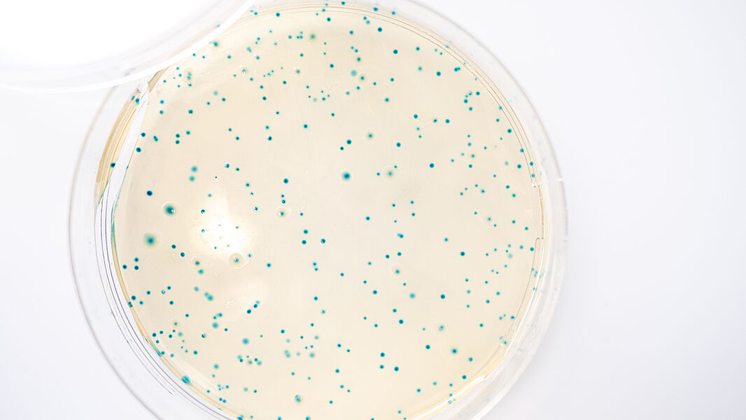 Listeria monocytogenes analyses microbiologiques