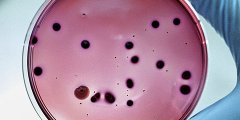 Petri dish for microbiological food analysis